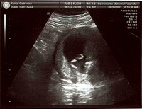 BabyKurtz_13w4d002