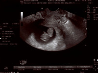 BabyKurtz_9w4d001