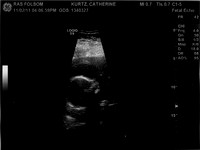 20weekultrasound_001