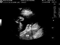 Chloe_27weeks_1