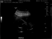 20weekultrasound_002